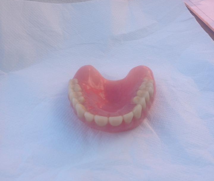 Ritrovata una dentiera a Sanremo