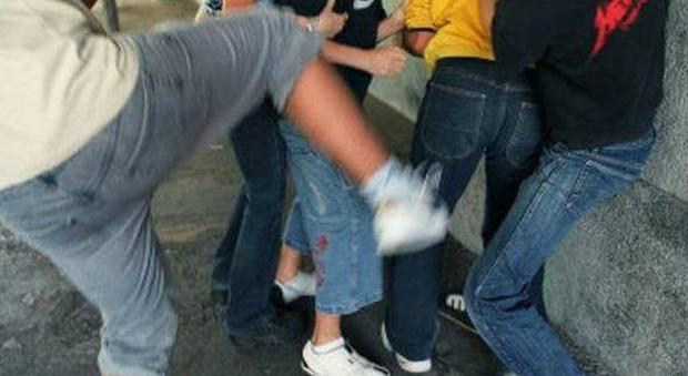 Lite per motivi di donne a Imperia: 15enne preso a pugni e testate perde due denti