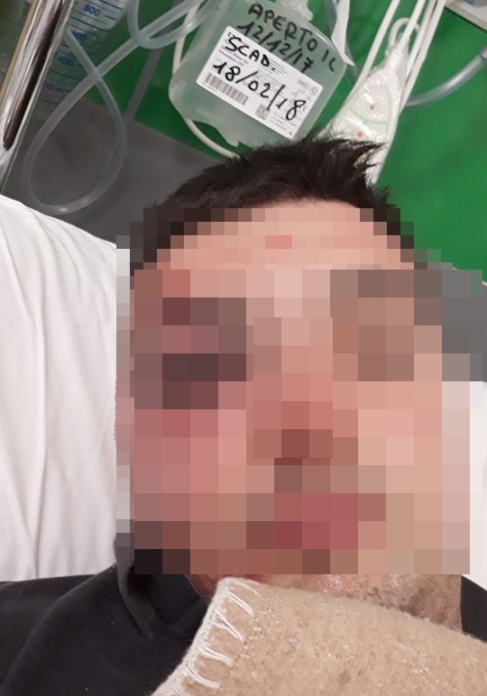 Un selfie dall’ospedale: “Ecco come sarà il mio Capodanno per colpa di un pirata…”