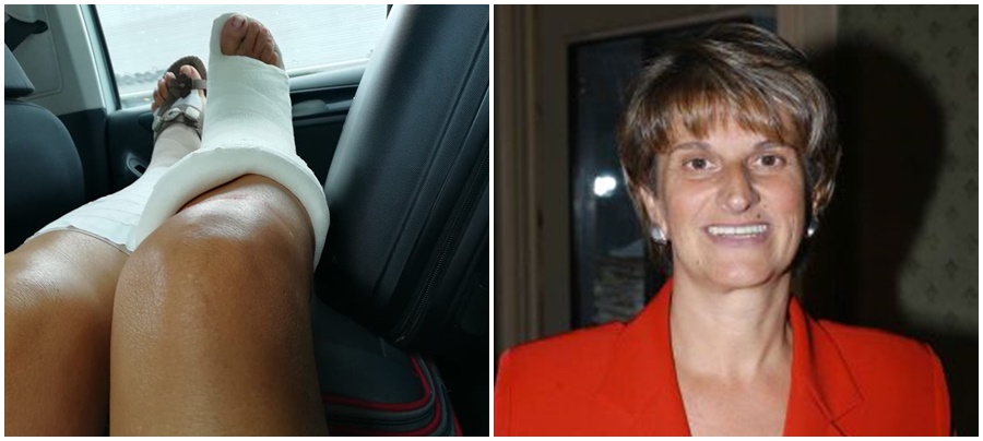 Fine ferie con gamba ingessata per il vicesindaco Marina Avegno