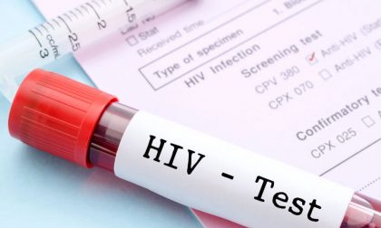 Test gratuiti contro il virus dell'Aids in provincia di Imperia