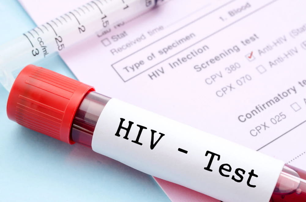 Test gratuiti contro il virus dell’Aids in provincia di Imperia