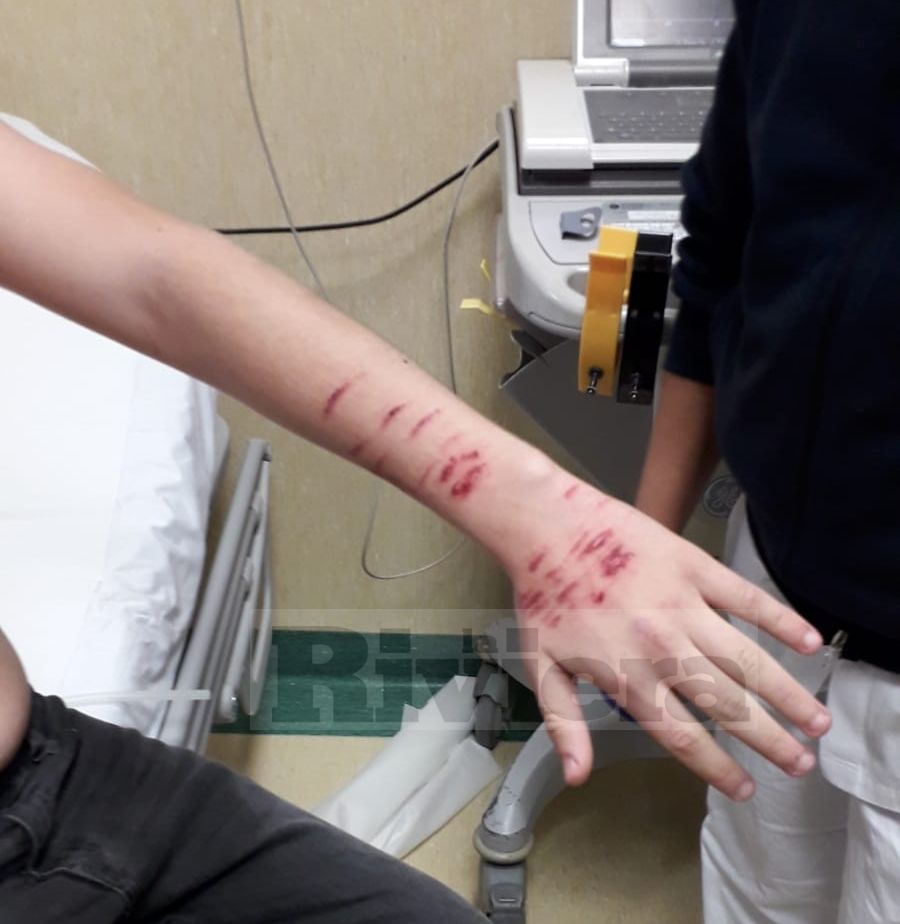 2Studente 14 anni ferito lametta Ventimiglia aggressione