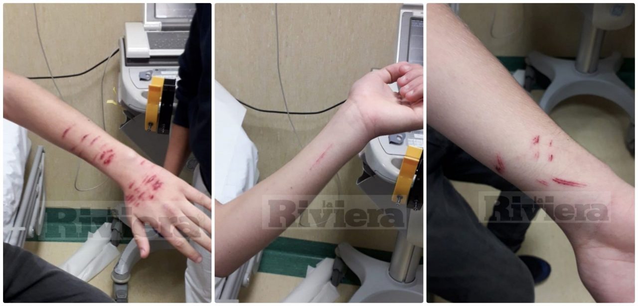 Aggressione choc: studente 14enne ferito con una lametta da due persone. Foto