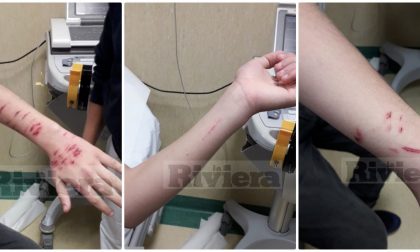 Aggressione choc: studente 14enne ferito con una lametta da due persone. Foto
