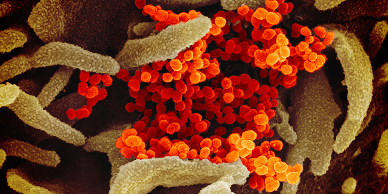 Coronavirus: si organizza anche il trasferimento degli ospiti piemontesi dagli alberghi di Alassio