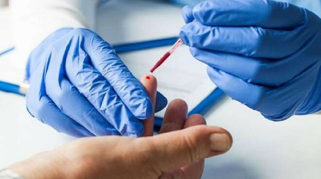 Test sierologici sui dipendenti: il Comune spende 600 euro