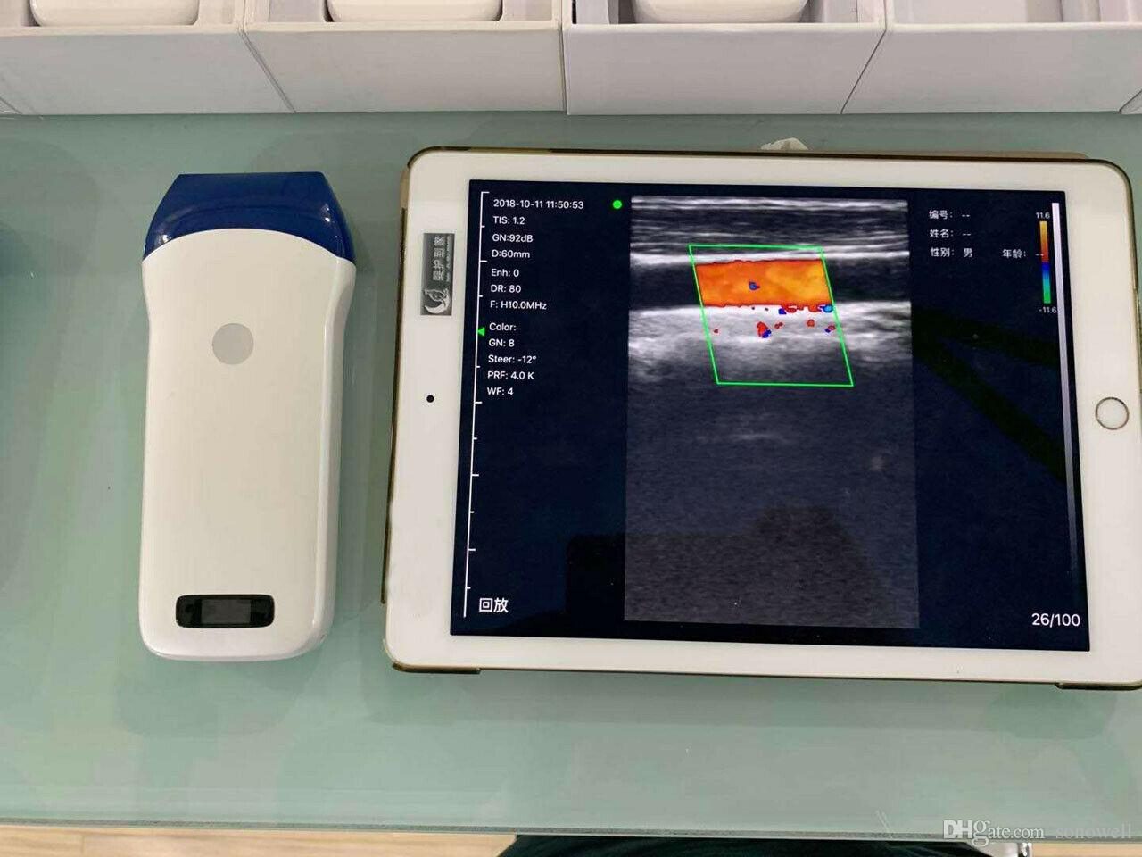Riccardo traverso Onlus regala quattro ecografi portatili agli ospedali