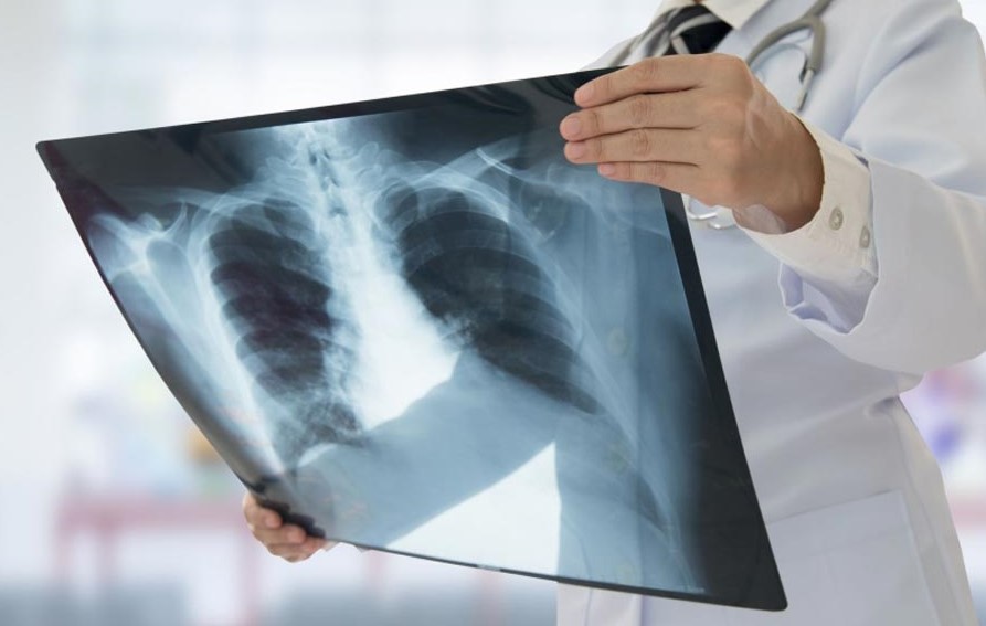 Sanità pubblica: Uil, “Continua la fuga dei lavoratori, sette tecnici di Radiologia pronti ad andarsene”