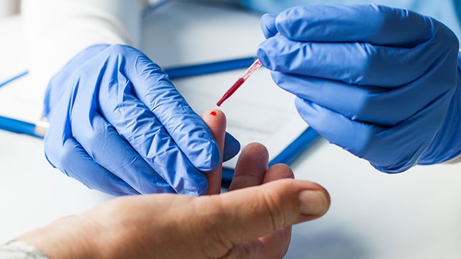 Ancora zero test sierologici sui poliziotti: SIAP contro Regione Liguria