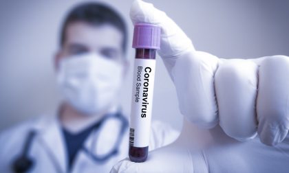 Coronavirus, 343 nuovi positivi su quasi 5mila tamponi