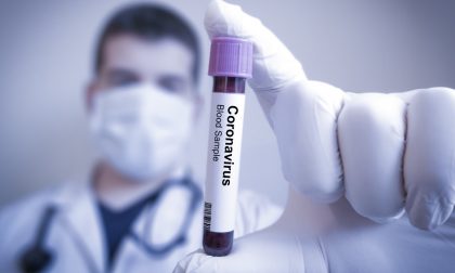 Coronavirus: 134 casi su oltre 2900 tamponi