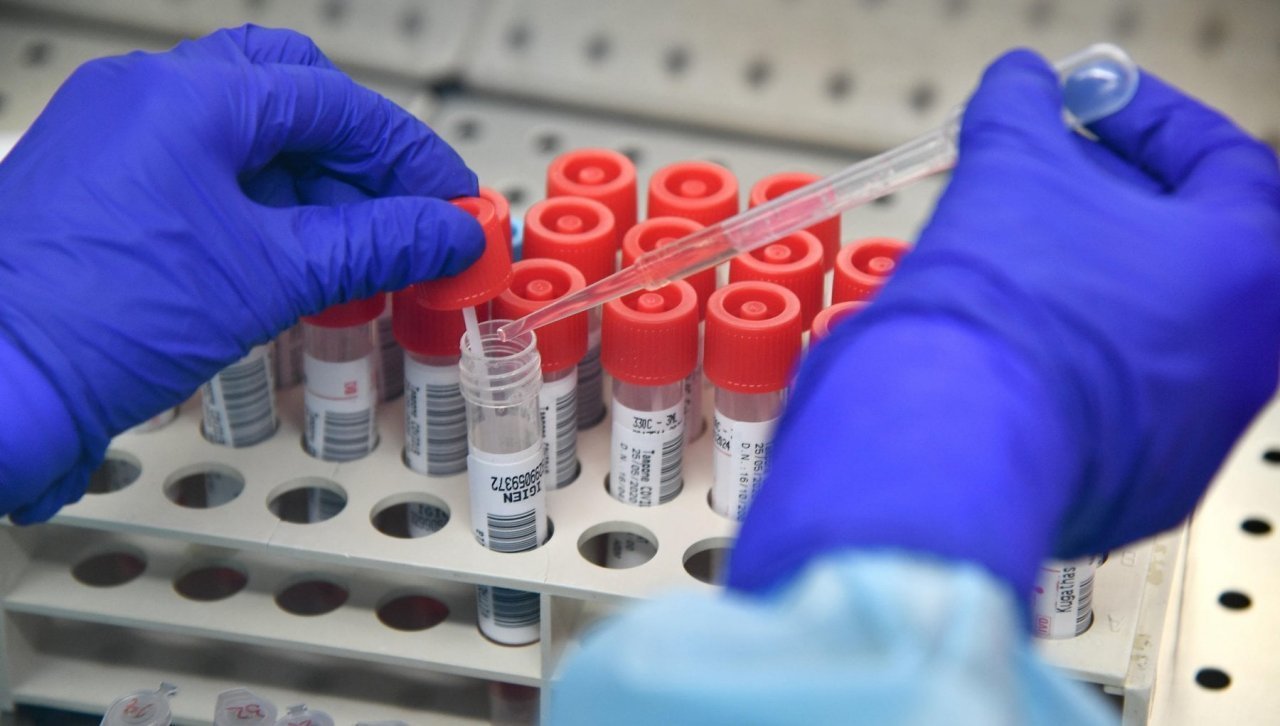 In Italia il primo caso della variante svizzera su un 57enne già contagiato dal Covid