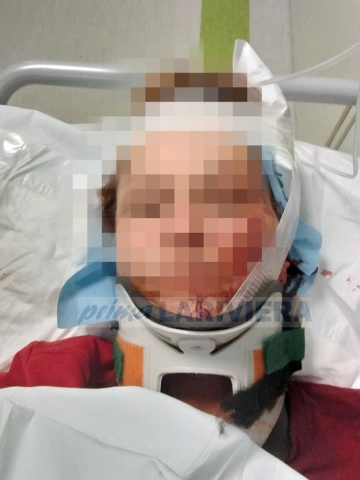 Choc a Ospedaletti: “Mi ha minacciata e poi massacrata: ora temo per la mia vita”