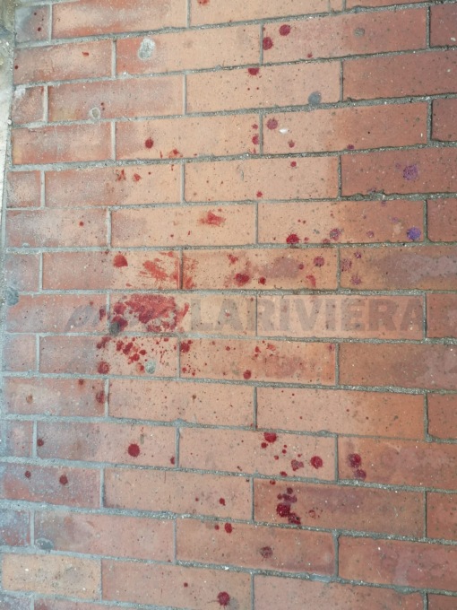 Massacra di botte per strada la madre della propria compagna a Ospedaletti