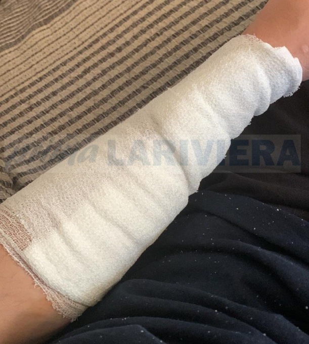 Cuoco 19enne di Sanremo ferito con una lama e rapinato a Ventimiglia