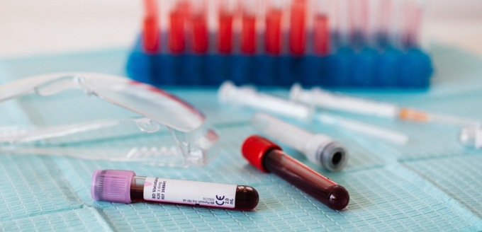 Problemi di rete nell’Asl 1: posticipati a domani i prelievi del sangue