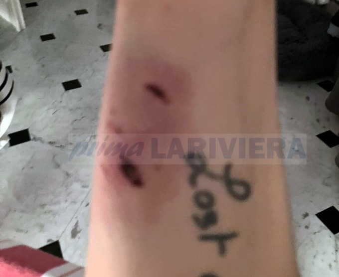 Ristoratore di Bordighera picchiato da un 14enne: “Intanto, non mi puoi toccare”