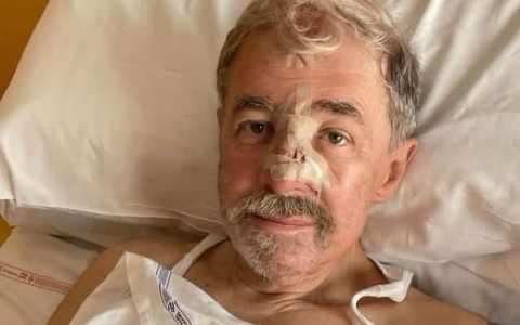 Il presidente Marco Bucci sottoposto a intervento di ricostruzione maxillo-facciale: “L’operazione è andata bene”
